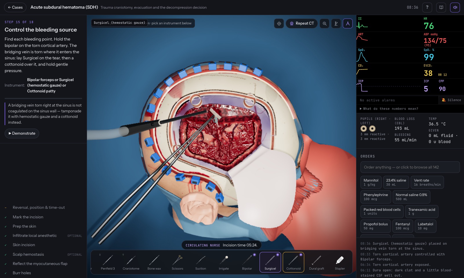 Clot evacuation in the epidural hematoma case